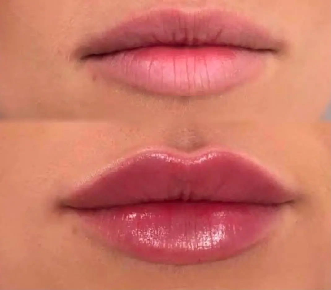 Skin treatment result at 3sixty